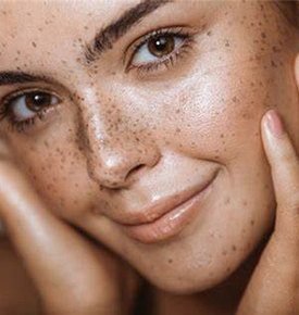 Jet Peel in Chișinău — piele strălucitoare fără durere și injecții!